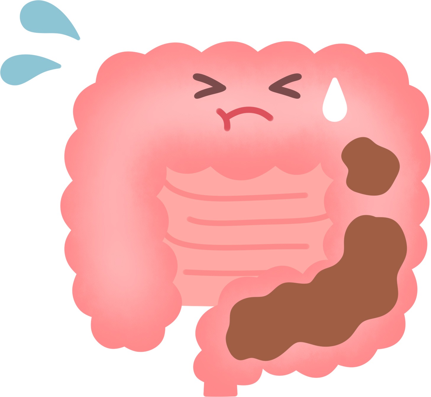 便秘