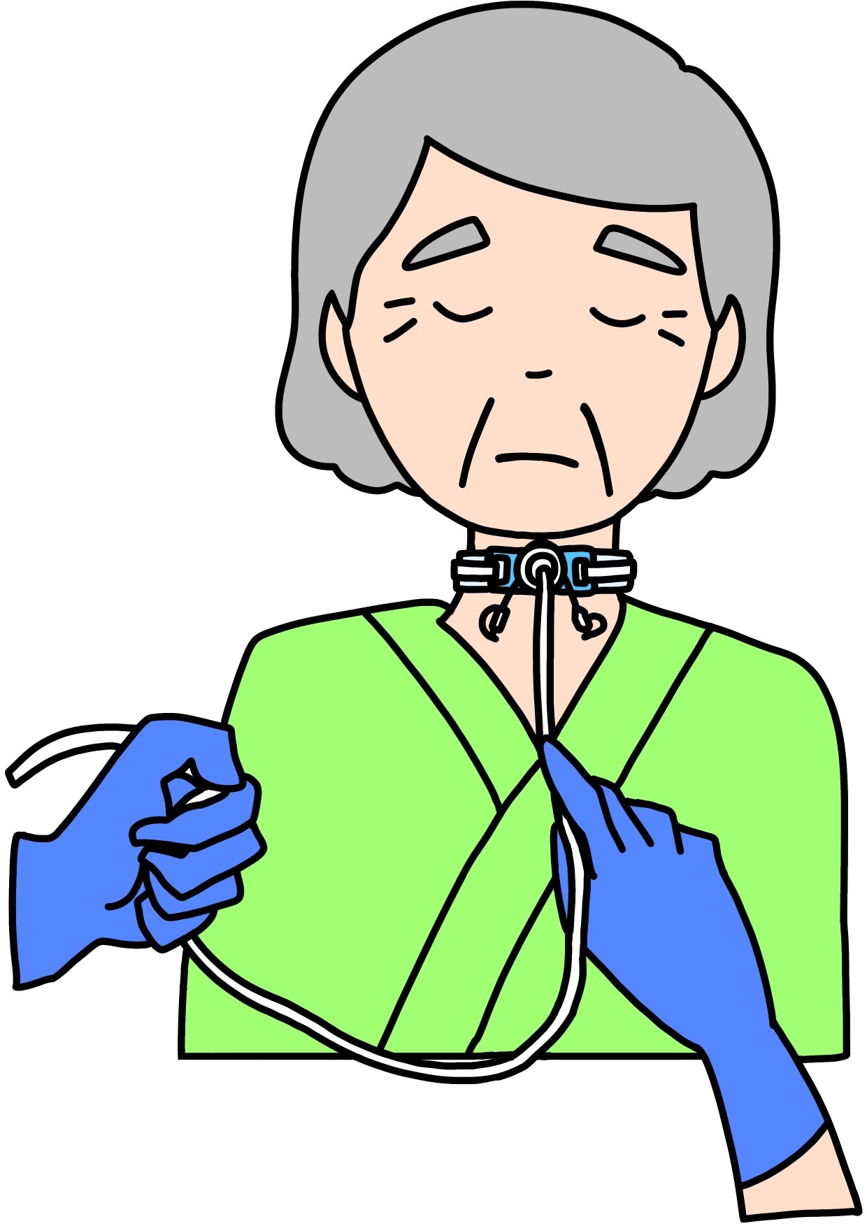 気管吸引
